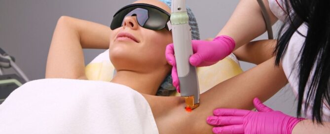 underarm laser hair removal