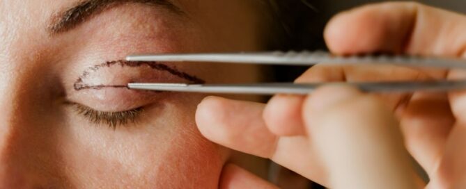 eyelid surgery